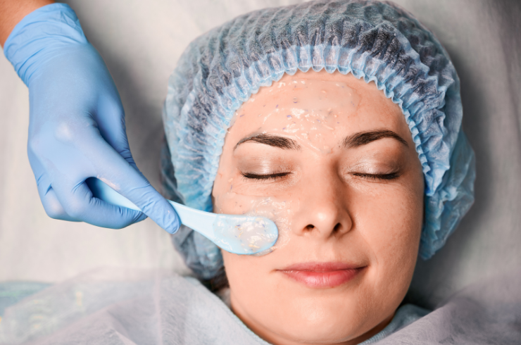 Chemical Peels